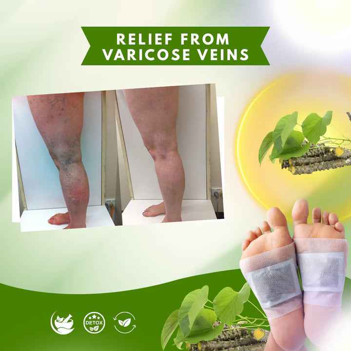 Herbal Giloy Detox Foot Patches | Body Detox Support, Stress Relief(1 BOX = 20 PATCHES-Buy 1 Get 3Free🔥🔥) - Needsly
