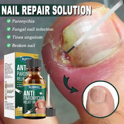 Anti Paronychia Relief Oil - Buy 1 Get 1 FREE🔥