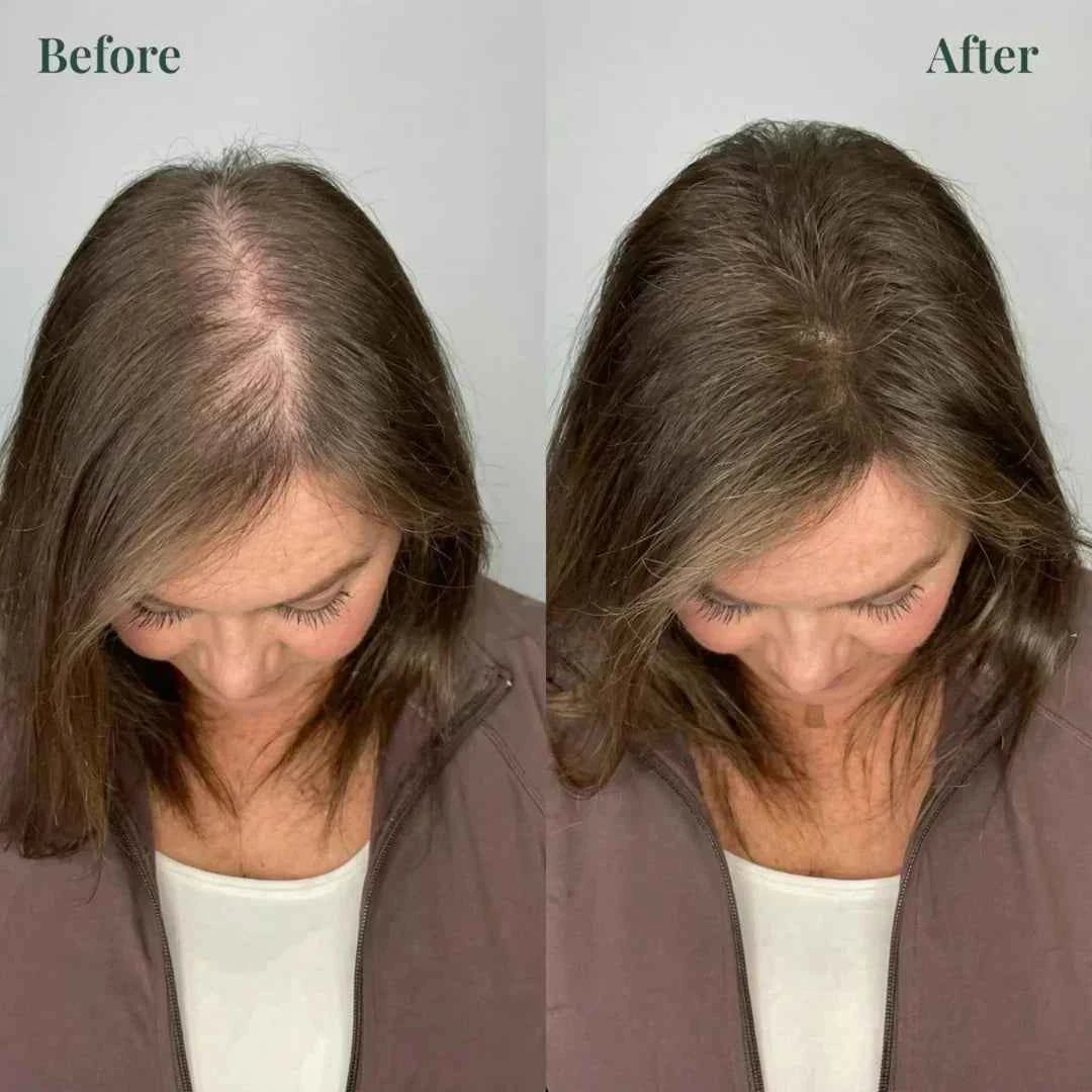 Kerarose Rosemary Shampoo For Hair Growth (Buy 1 Get 1 Free 🔥🔥)