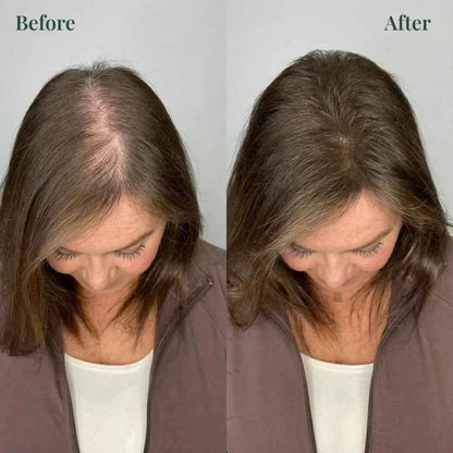 Kerarose Rosemary Shampoo For Hair Growth (Buy 1 Get 1 Free 🔥🔥)